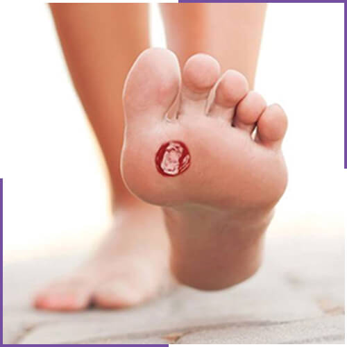 Yara Bakımı & Kronik Yara Bakımı